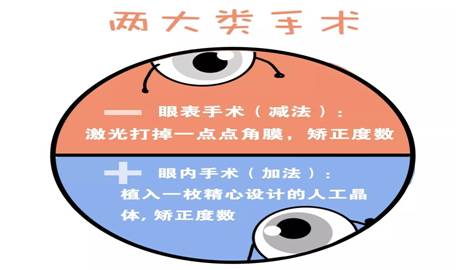 最新近視矯正技術(shù),最新近視矯正技術(shù)，重塑清晰視界